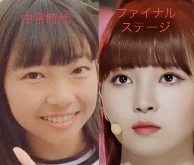 NiziUマユカの顔が可愛くなった！目や鼻など整形？過去画像と比較！